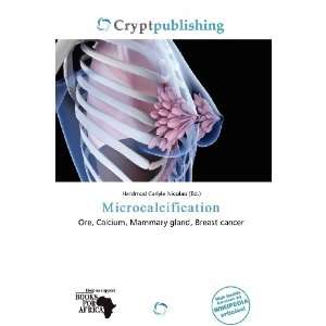   Microcalcification (9786200541536) Hardmod Carlyle Nicolao Books