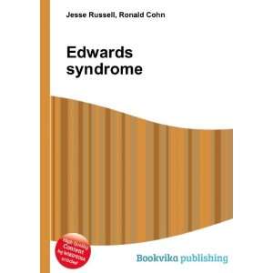  Edwards syndrome Ronald Cohn Jesse Russell Books