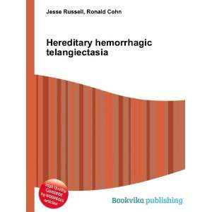 Hereditary hemorrhagic telangiectasia Ronald Cohn Jesse Russell 