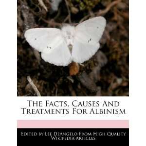  The Facts, Causes And Treatments For Albinism 